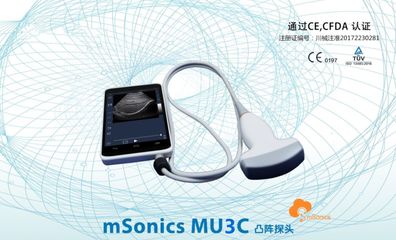 手机变超声,掌上超声百家争鸣:GE、飞利浦、飞依诺